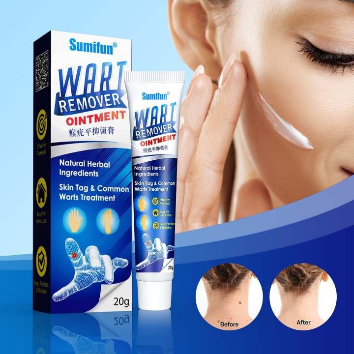 Wart Remover Ointment - Wart Treatment Cream & Skin Tag Remover - 20g